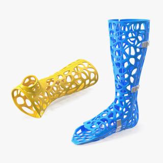 3D -Printed Orthopedic Casts Collection