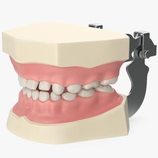 3D Dental Anatomy Educational Pediatric Kit with Removable Open Bite Teeth