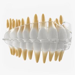 3D Dental Orthodontic Tooth Retainer model