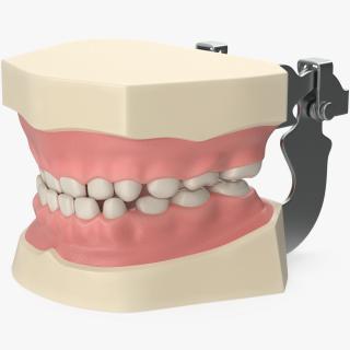 3D Typodont Teaching Studying Model with Removable Underbite Teeth model