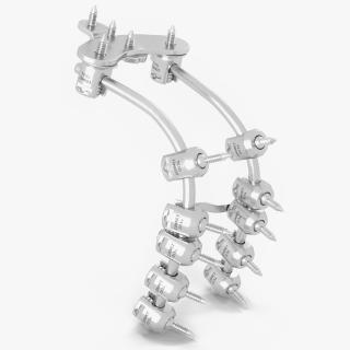 Posterior Cervical Spine Fixation System 2 3D