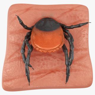 3D Tick Stuck in Skin model