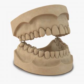 3D Dental Mold