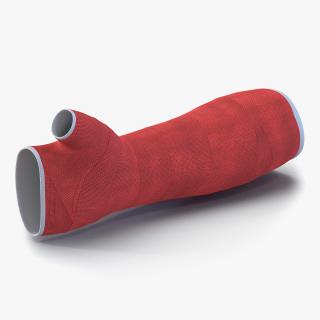 Orthopedic Cast Arm 3D model