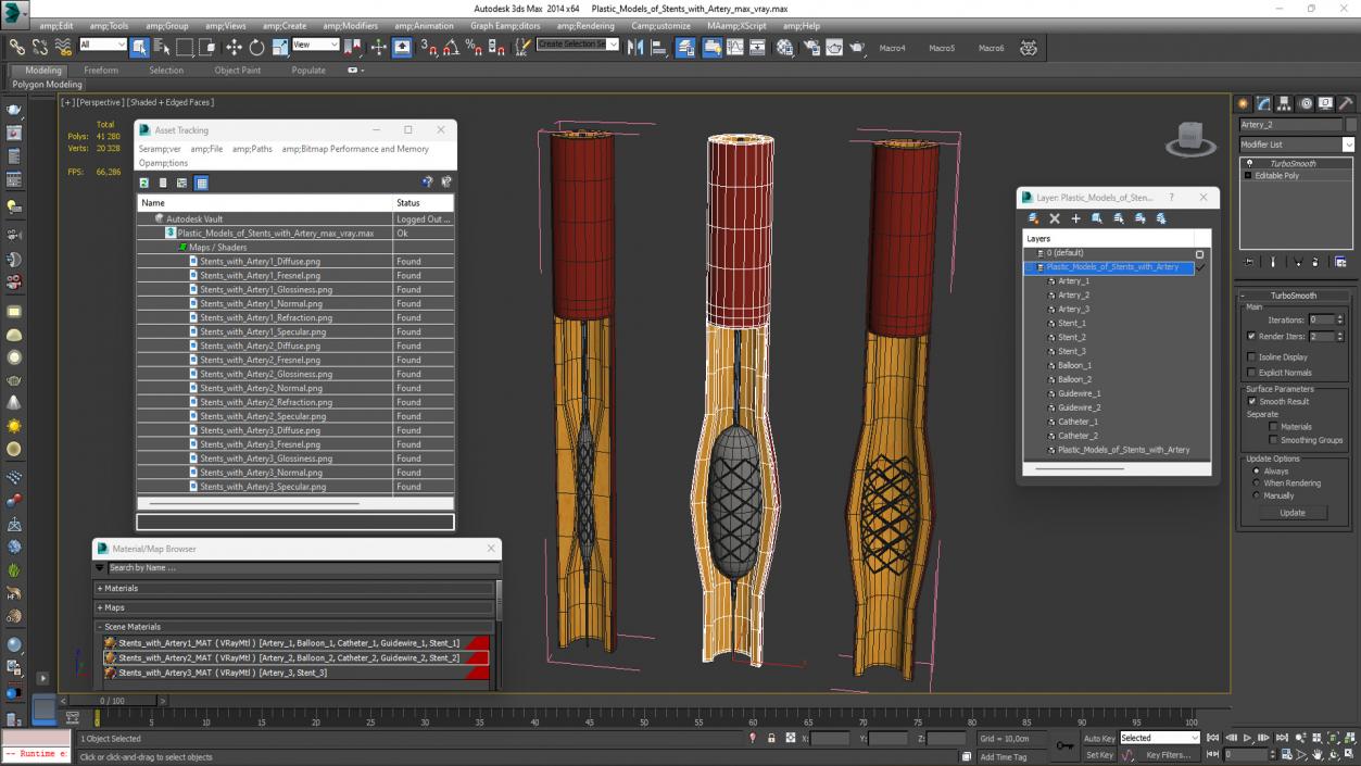 3D Plastic Models of Stents with Artery 2 model