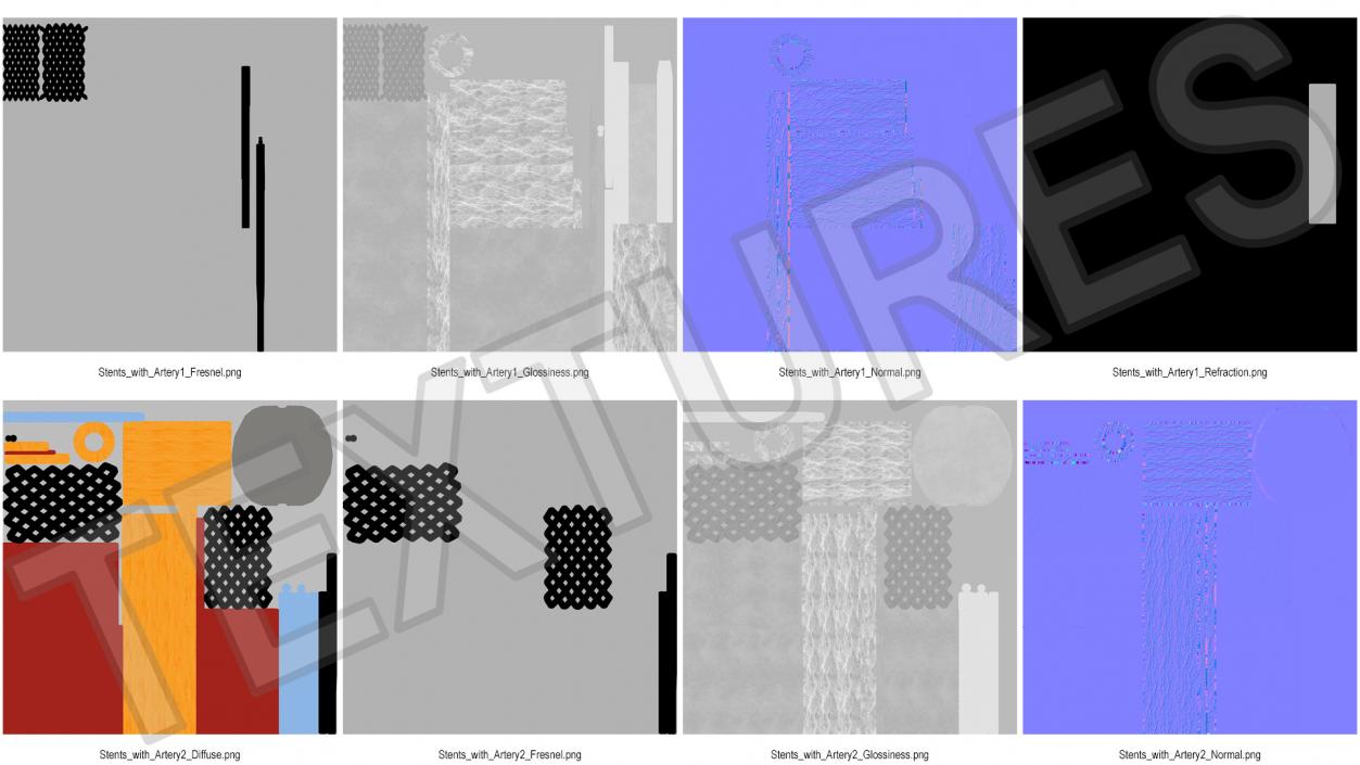 3D Plastic Models of Stents with Artery 2 model