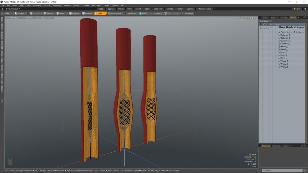 3D Plastic Models of Stents with Artery 2 model