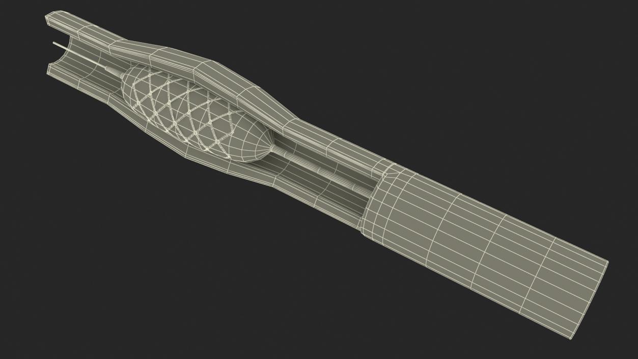 3D Plastic Models of Stents with Artery 2 model