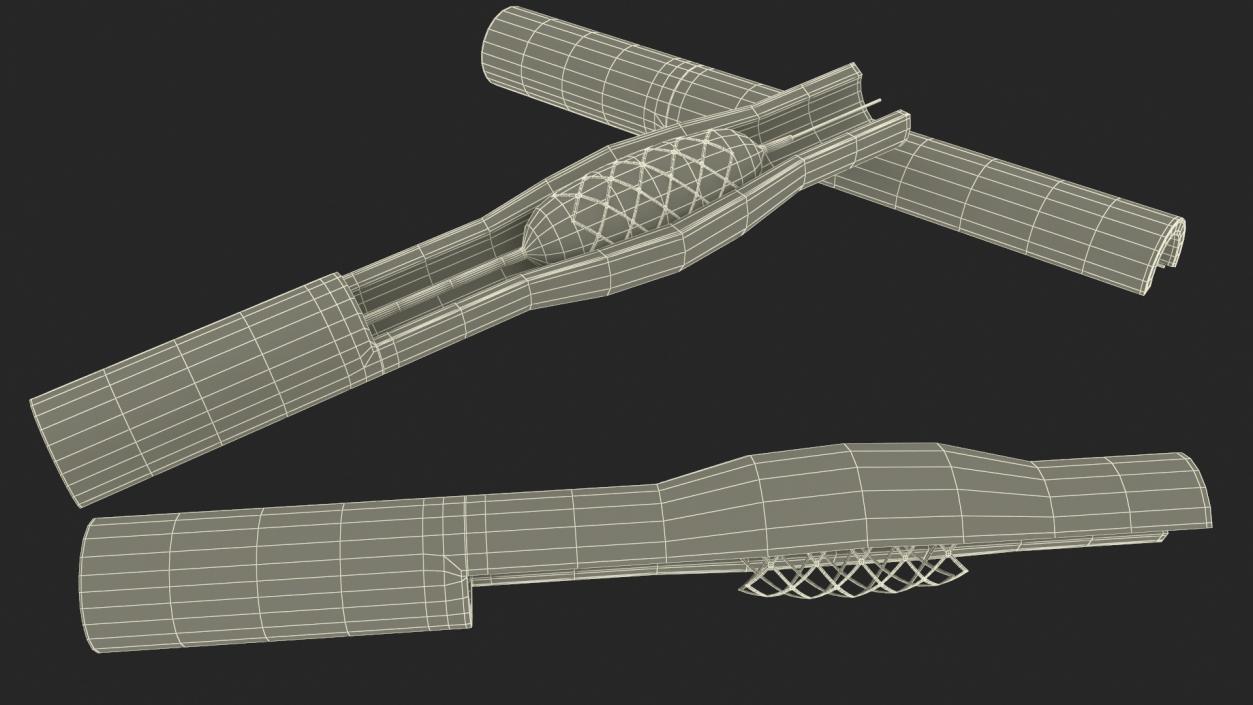 3D Plastic Models of Stents with Artery 2 model