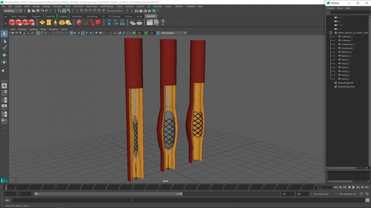 3D Plastic Models of Stents with Artery 2 model