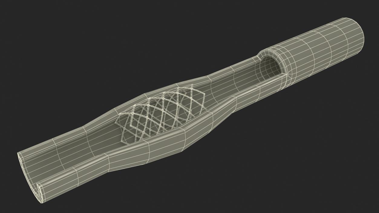 3D Plastic Models of Stents with Artery 2 model