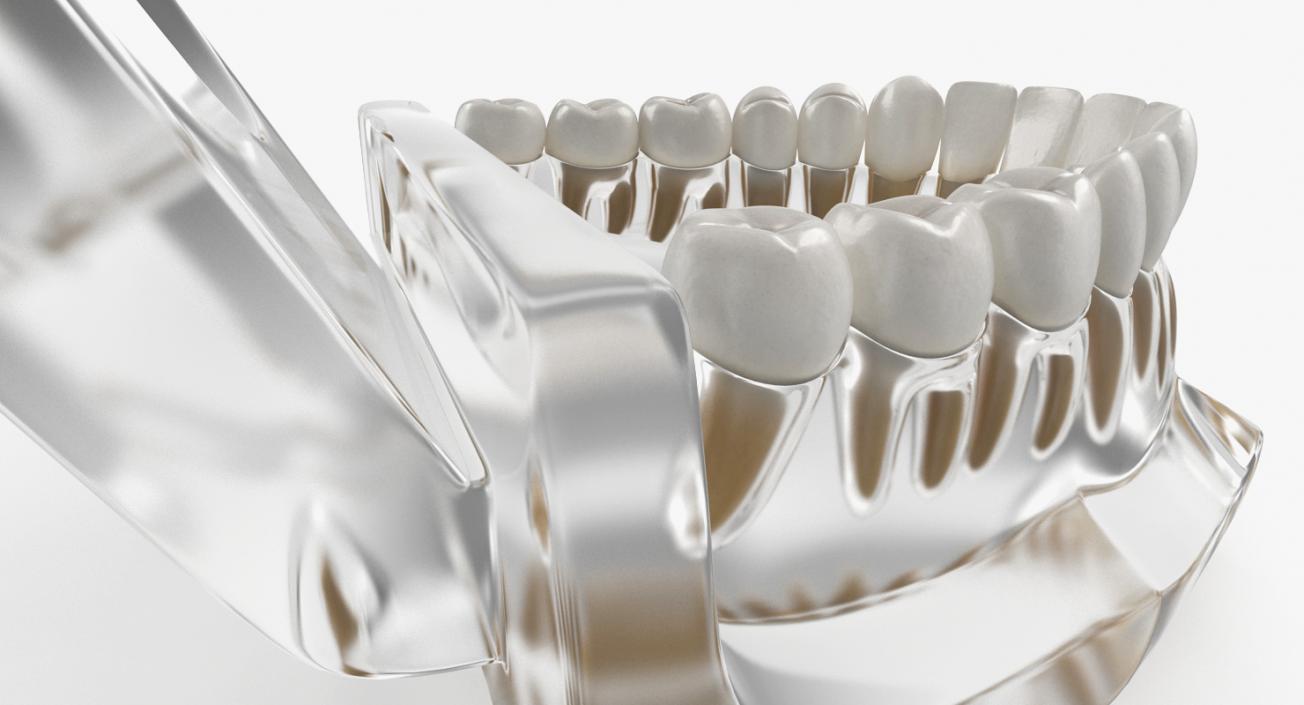 Dental Collection 3 3D model