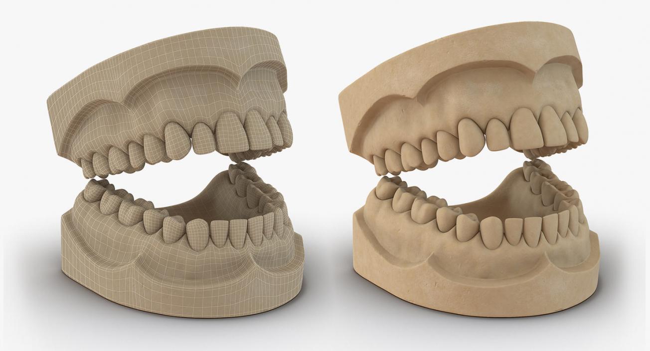 Dental Collection 3 3D model