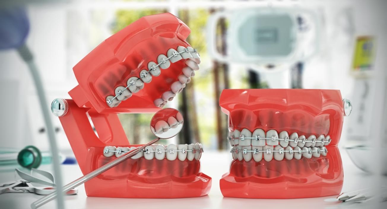 Dental Collection 3 3D model