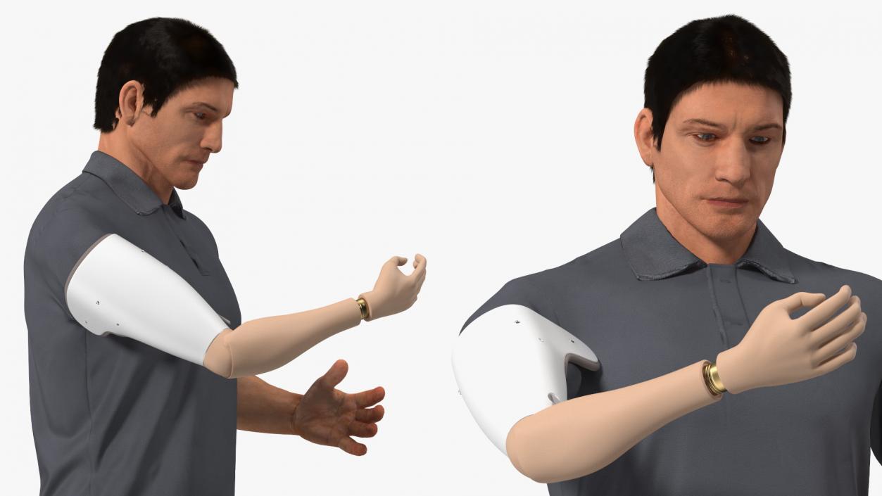 Man with Prosthetic Arm Fur 3D