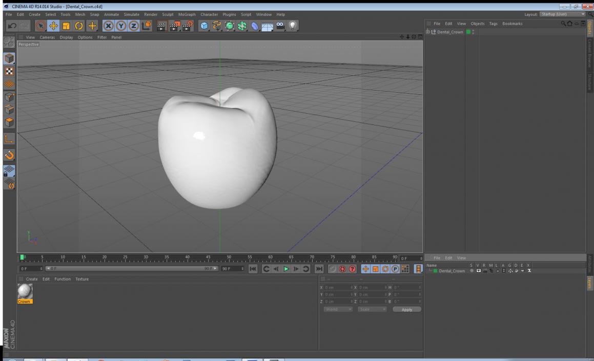 Dental Crown 3D