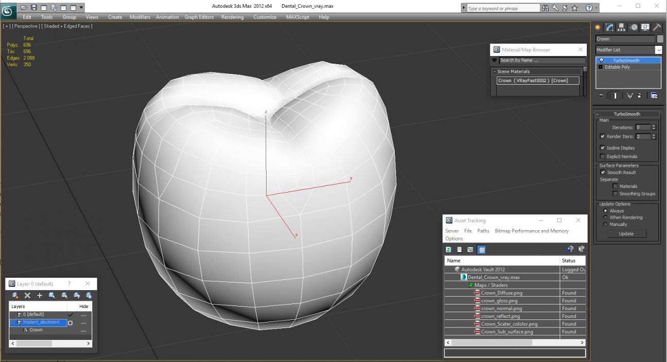 Dental Crown 3D