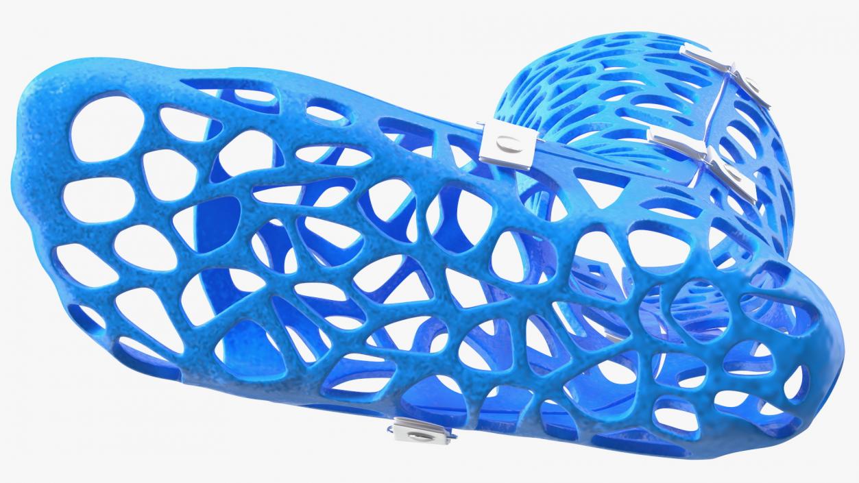 3D -Printed Orthopedic Cast Leg Blue model