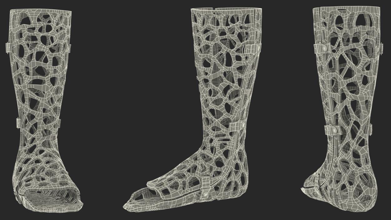 3D -Printed Orthopedic Cast Leg Blue model