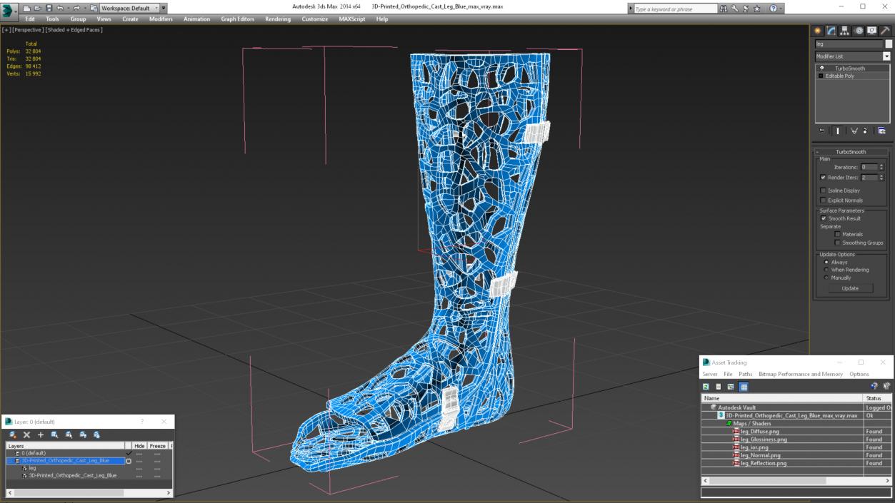 3D -Printed Orthopedic Cast Leg Blue model