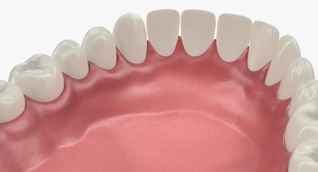 3D model Lower Teeth Medical Model With Dental Implant