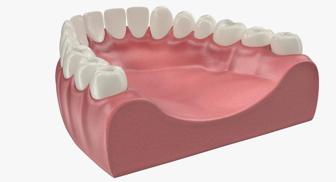 3D model Lower Teeth Medical Model With Dental Implant