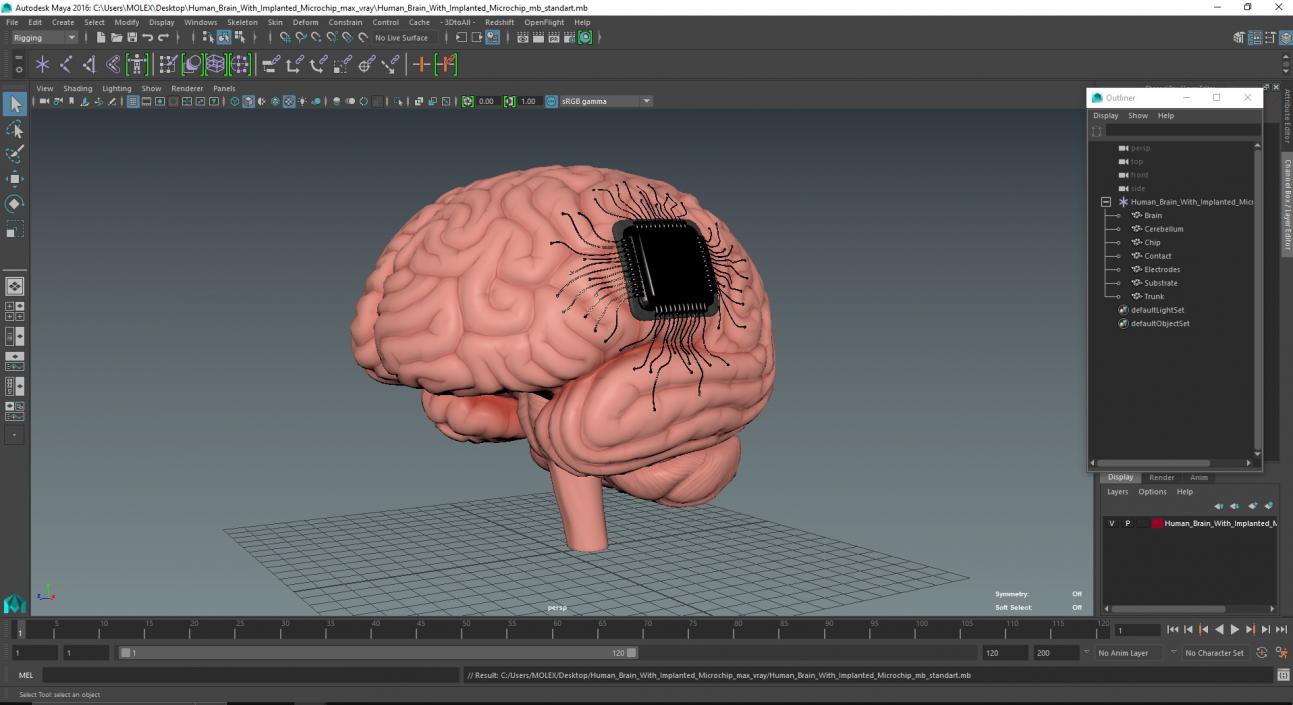 3D Human Brain With Implanted Microchip 2 model