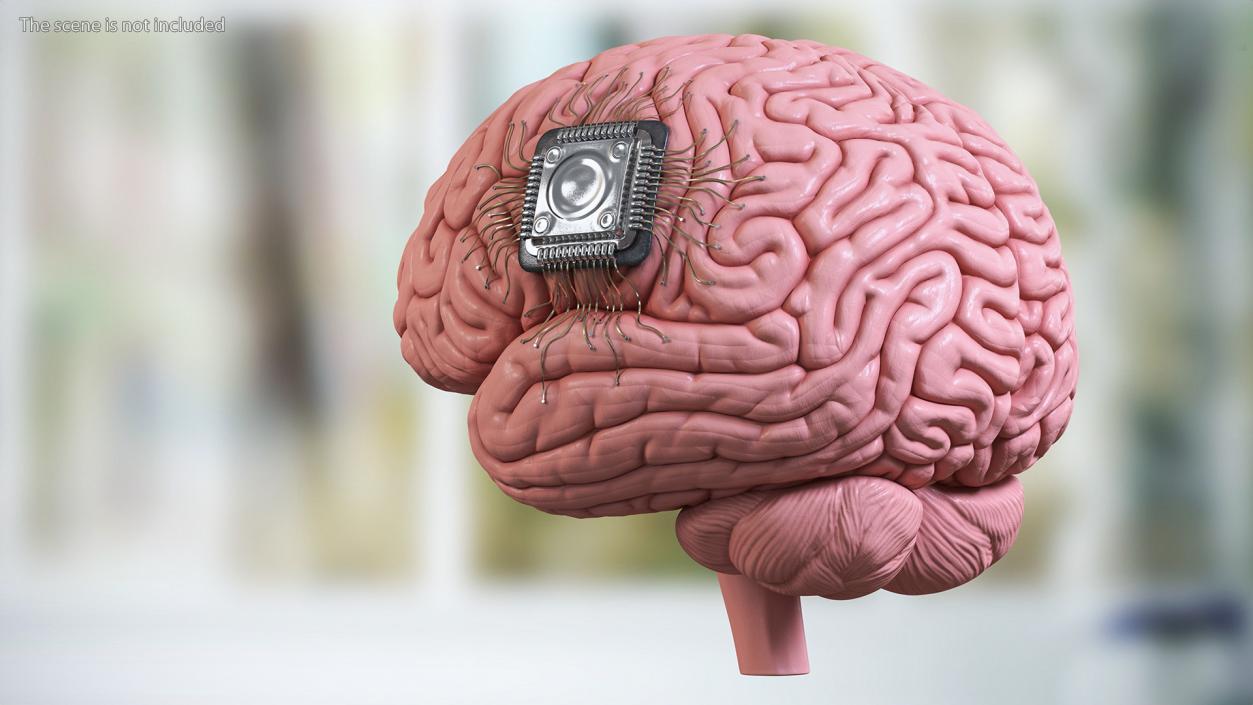 3D Human Brain With Implanted Microchip 2 model