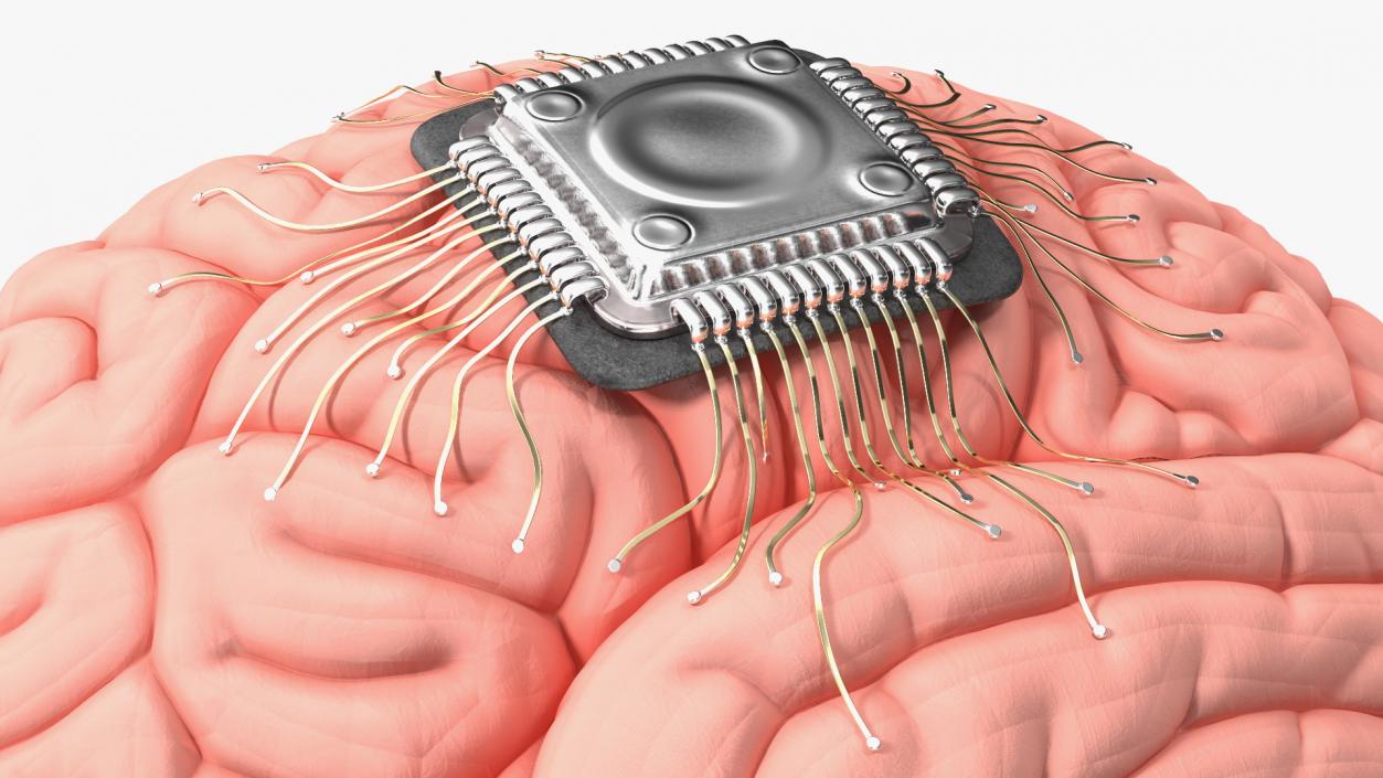 3D Human Brain With Implanted Microchip 2 model