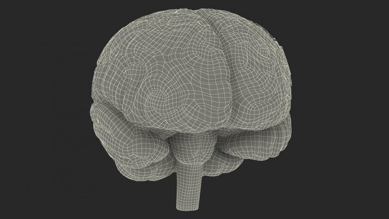 3D Human Brain With Implanted Microchip 2 model