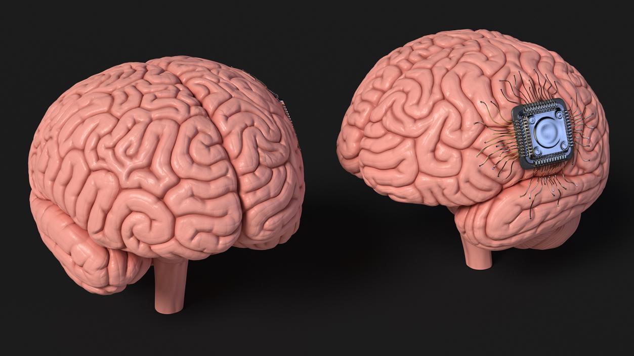 3D Human Brain With Implanted Microchip 2 model