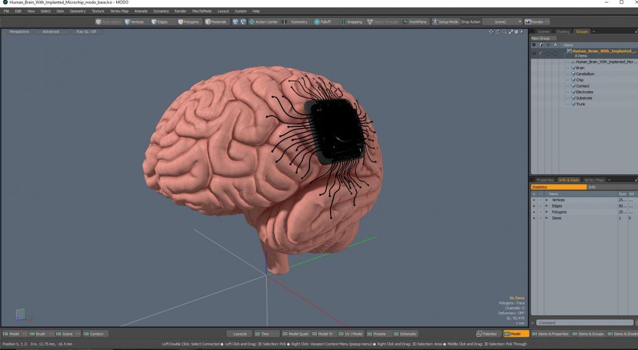 3D Human Brain With Implanted Microchip 2 model