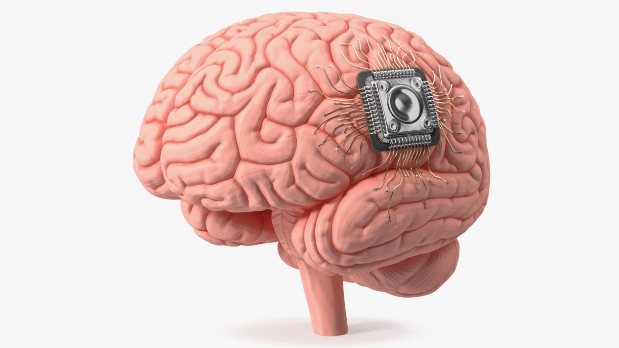 3D Human Brain With Implanted Microchip 2 model