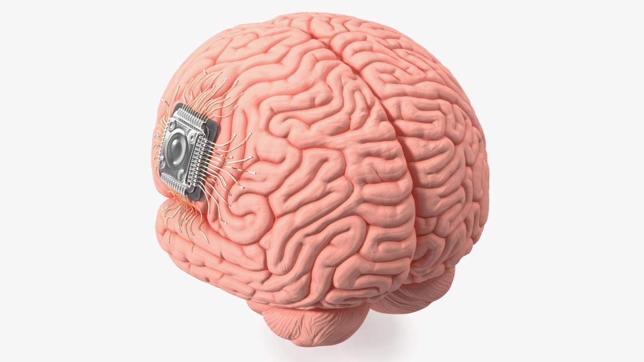 3D Human Brain With Implanted Microchip 2 model