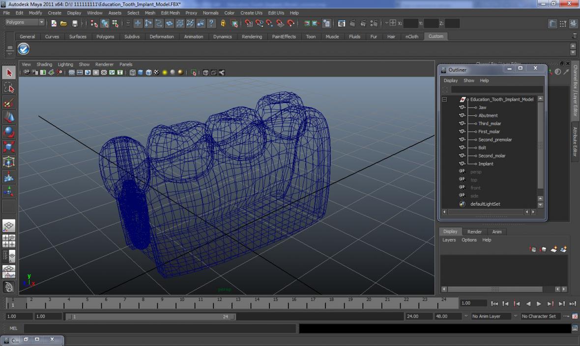 3D Education Tooth Implant model