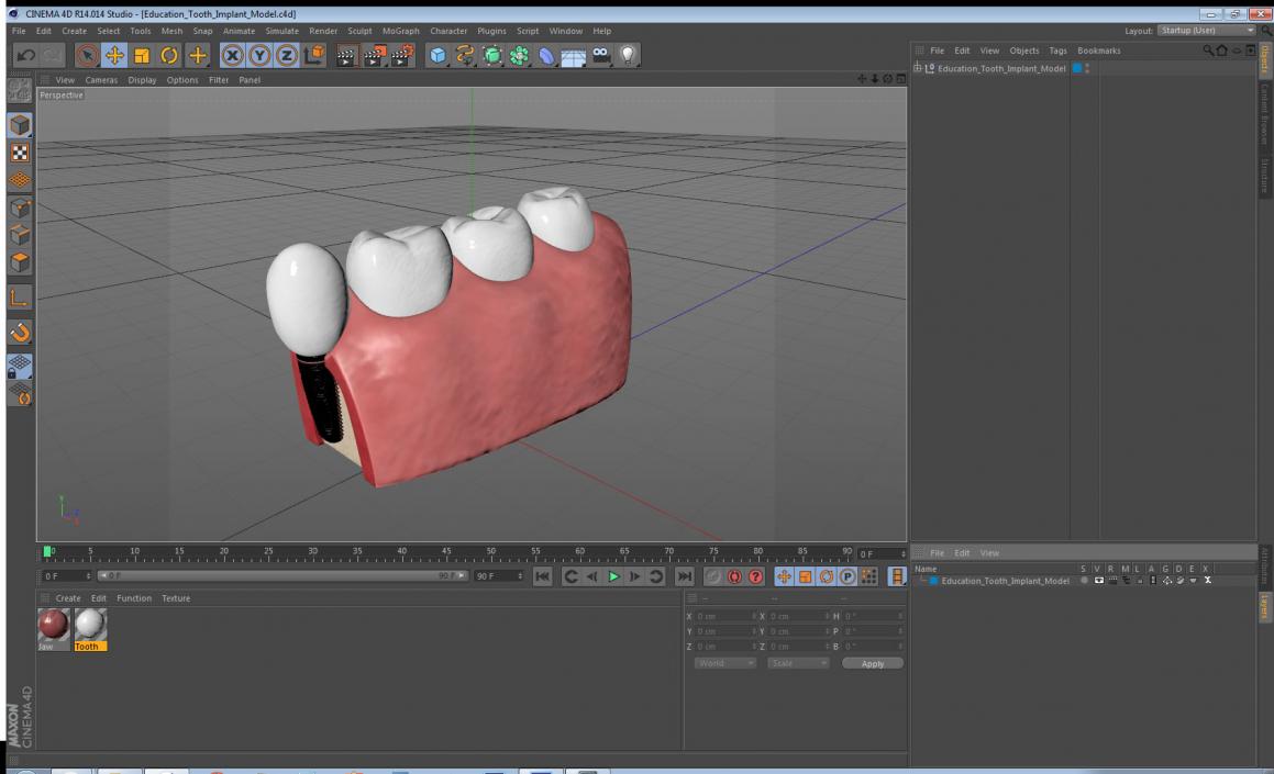 3D Education Tooth Implant model