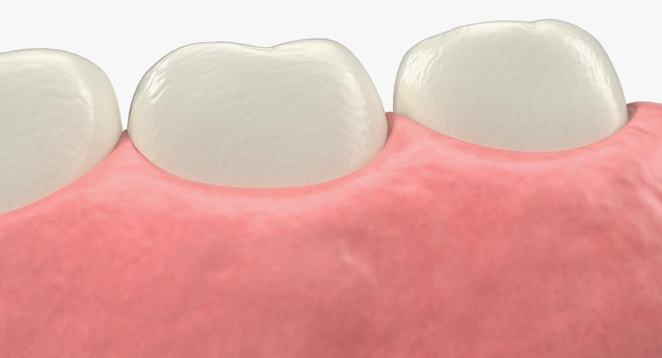 3D Education Tooth Implant model