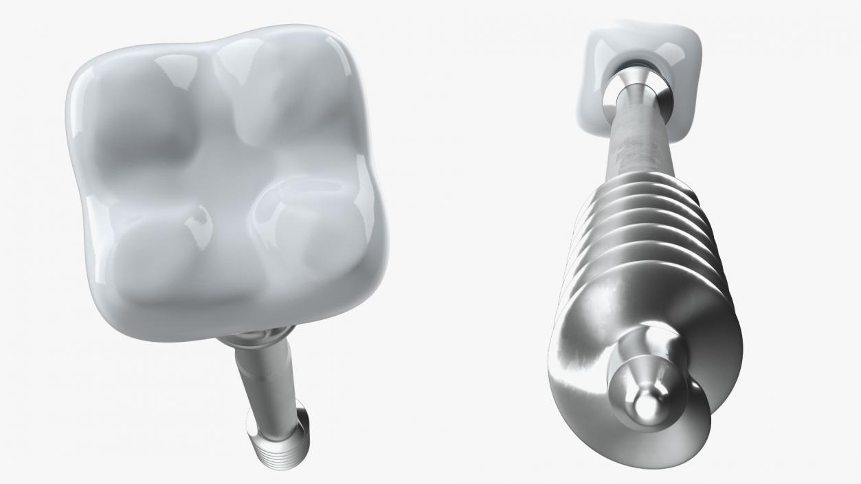 3D model Zygomatic Dental Implants