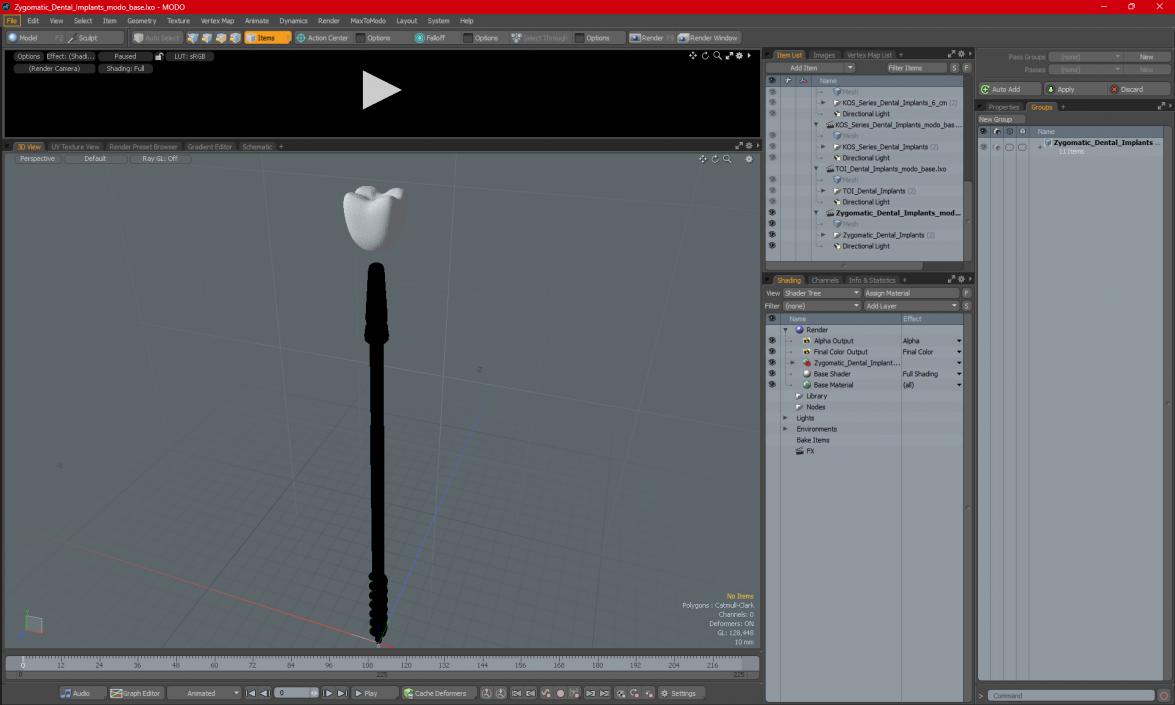 3D model Zygomatic Dental Implants