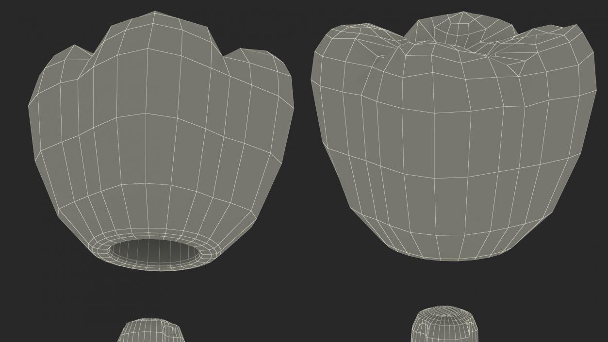 3D model Zygomatic Dental Implants