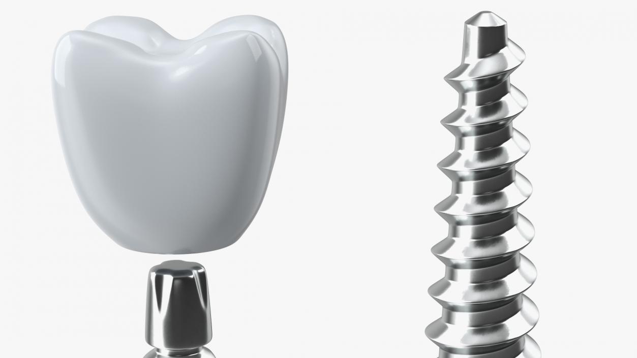 Tooth Implants Collection 3 3D