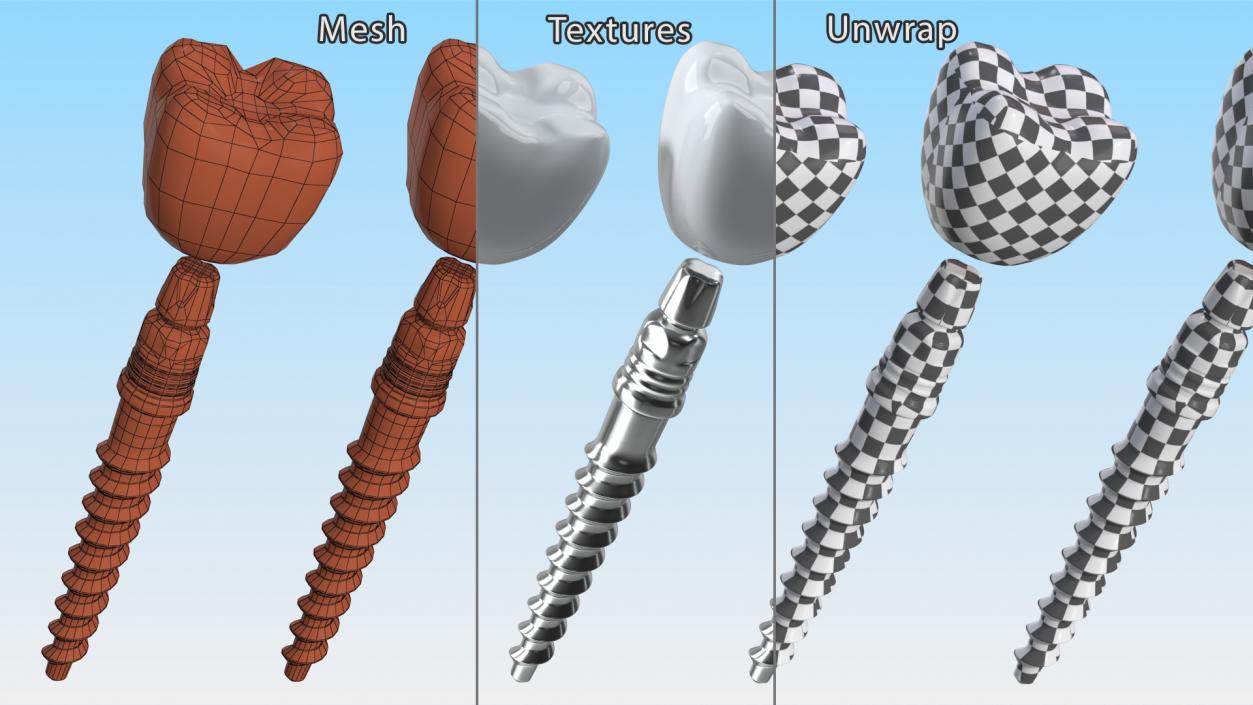 Tooth Implants Collection 3 3D