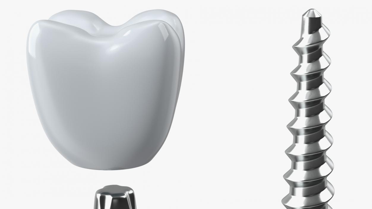 Tooth Implants Collection 3 3D