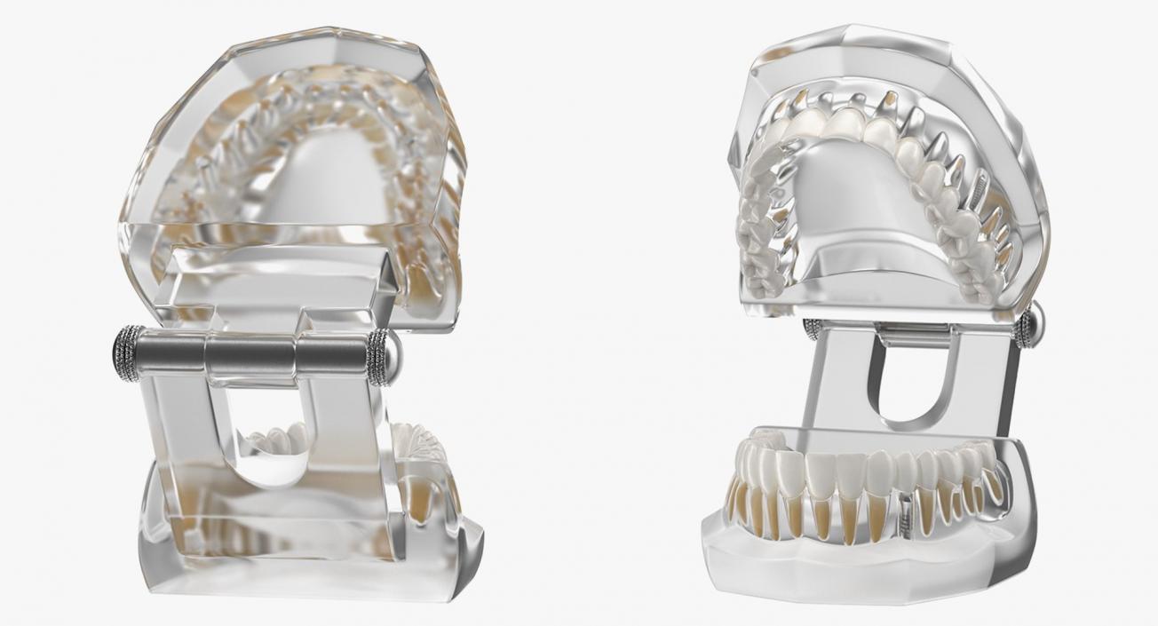 Tooth Implants Collection 3 3D