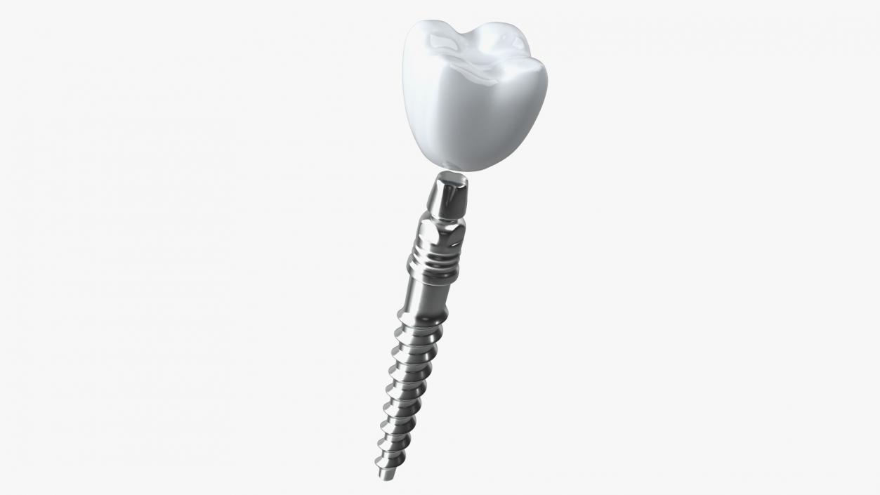 Tooth Implants Collection 3 3D