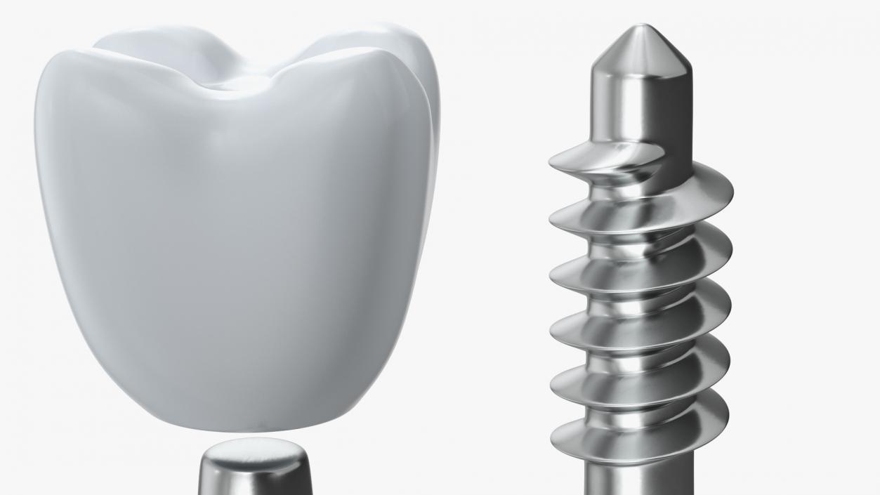 Tooth Implants Collection 3 3D