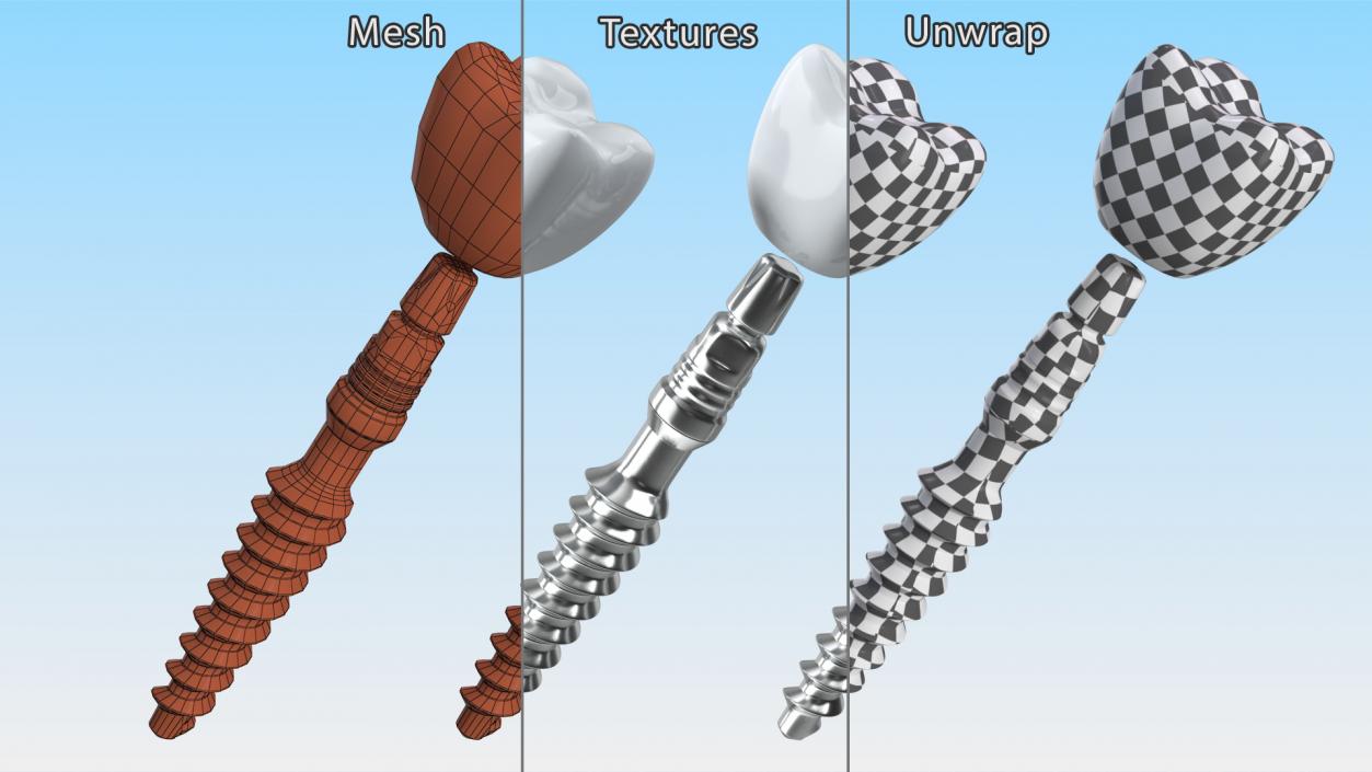 Tooth Implants Collection 3 3D