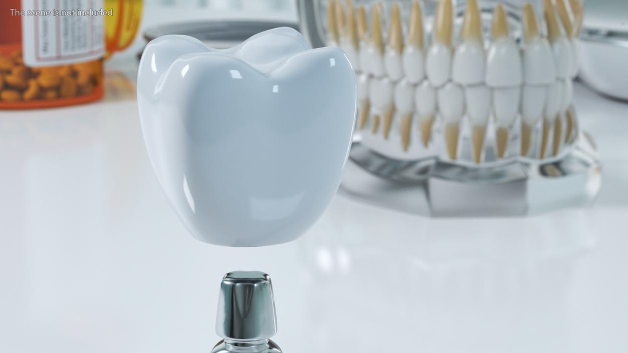 Tooth Implants Collection 3 3D