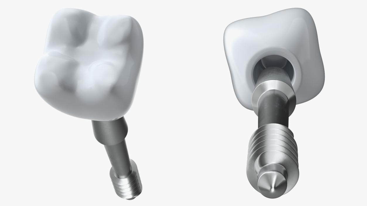 Tooth Implants Collection 3 3D