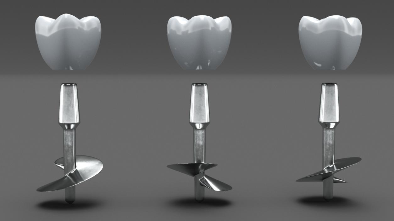 Tooth Implants Collection 3 3D